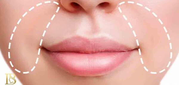 عکس ژل لب خنده دار