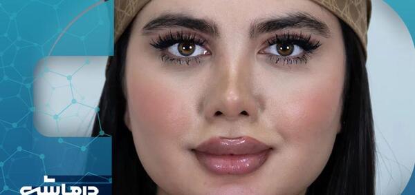 عکس ژل لب خنده دار