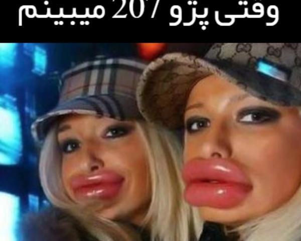 عکس لب بزرگ خنده دار