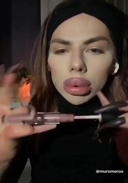 عکس لب پروتز شده خنده دار