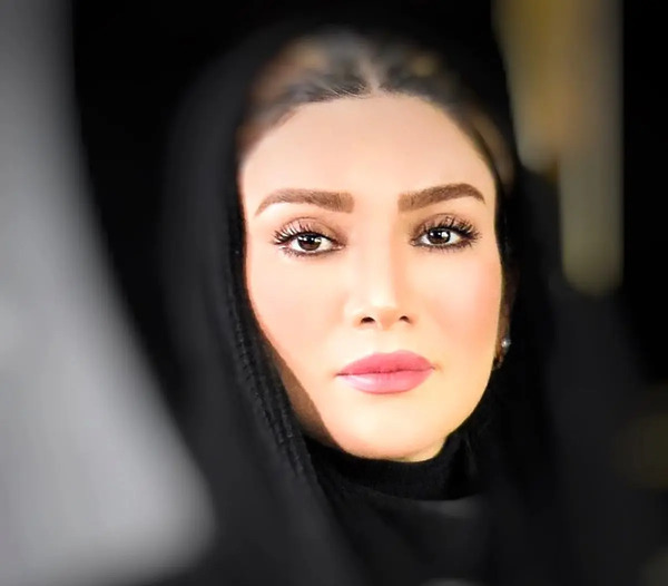 عکس لب پروتز شده خنده دار