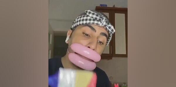 عکس لب پروتز شده خنده دار