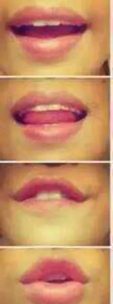 عکس لب خونی طبیعی