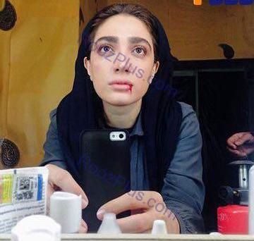 عکس لب های خونی