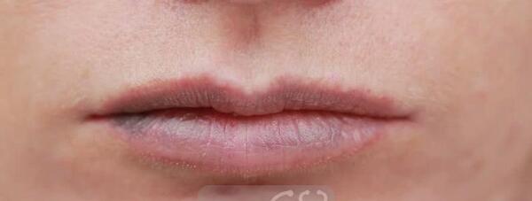 عکس لب های خونی