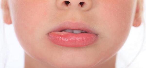 عکس لب های خونی