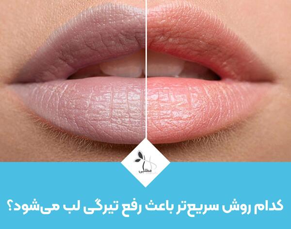 عکس لب های خونی