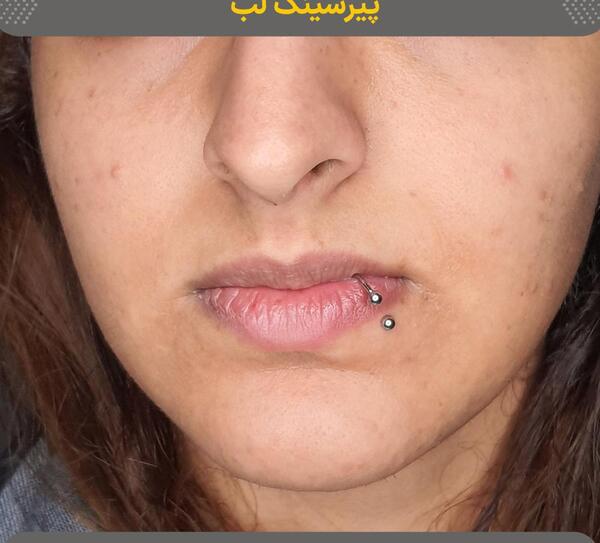 عکس پیرسینگ لب حلقه ای