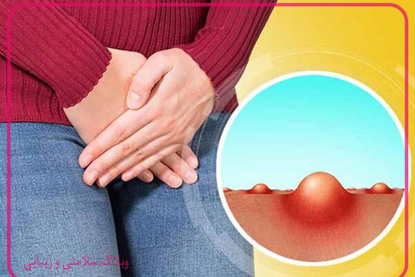 عکس های لب جوشی