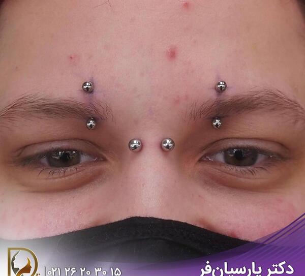 عکس جونگ کوک با پیرسینگ لب
