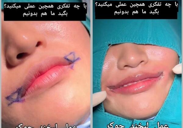 عکس لب جوکری