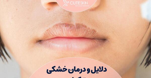 عکس لب های ترک خورده