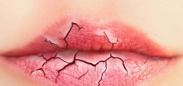 عکس لب های خشک و ترک خورده