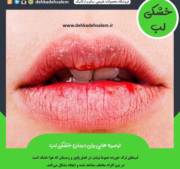 عکس لب های خشک و ترک خورده
