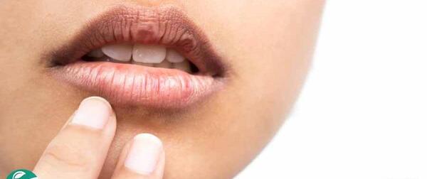 عکس لب های خشک و ترک خورده
