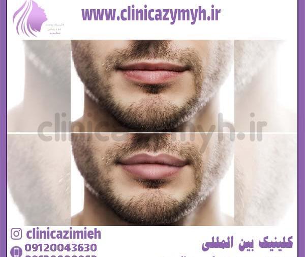 عکس رژ لب پسرانه