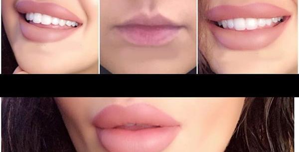 عکس ژل لب مدل اردکی