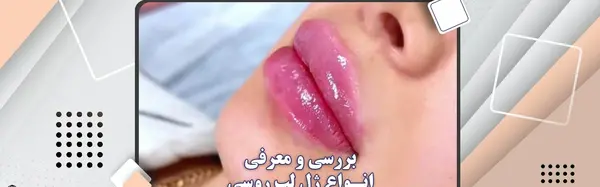 عکس ژل لب مدل اردکی