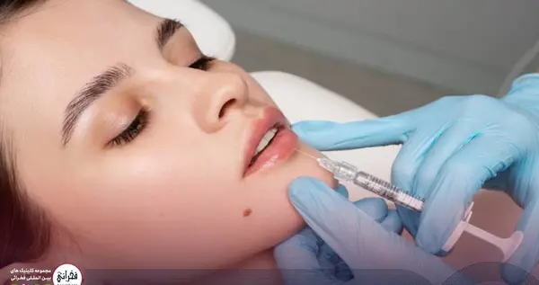 عکس ژل لب مدل اردکی