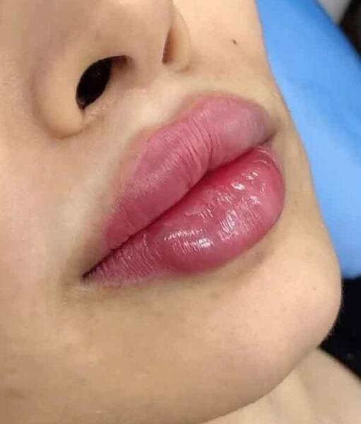 عکس ژل لب مدل اردکی
