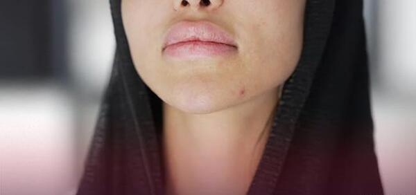 عکس ژل لب مدل اردکی