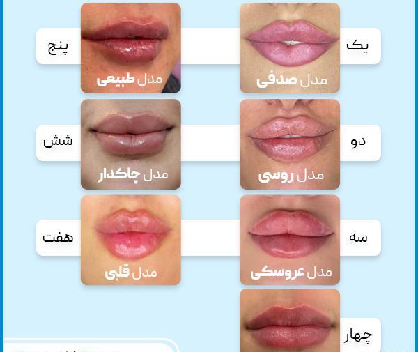 عکس ژل لب مدل اردکی