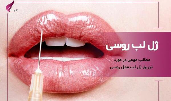 عکس ژل لب مدل اردکی