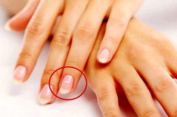 عکس ناخن های کوتاه زشت
