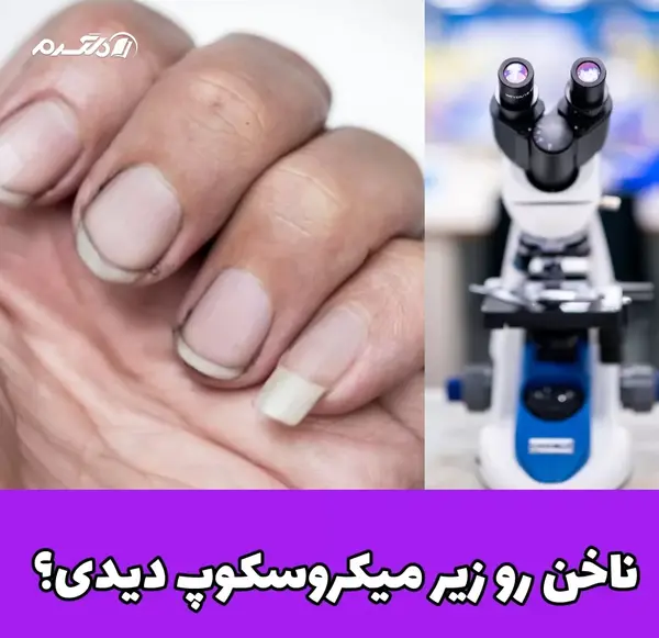 ناخن عکس میکروب واقعی