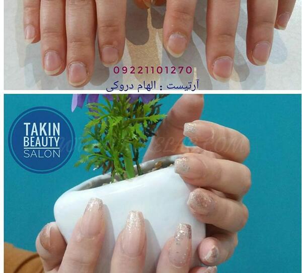 عکس ناخن قبل از کاشت