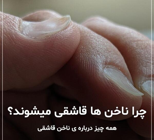 عکس ناخن قاشقی شکل
