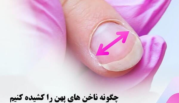 عکس ناخن قاشقی شکل