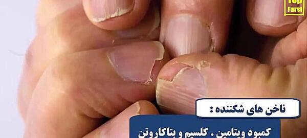 عکس ناخن های قاشقی