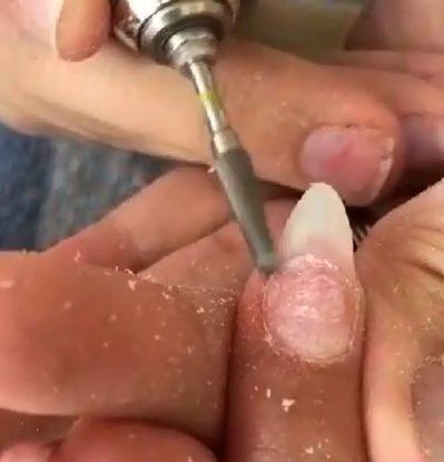 عکس ناخن کاشت شکسته شده