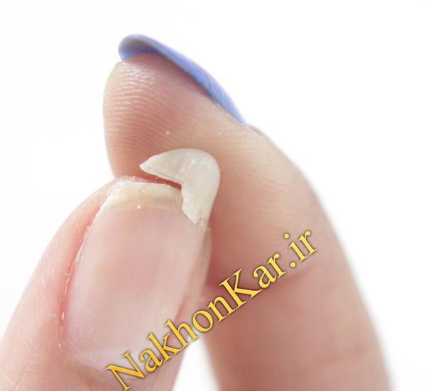 عکس ناخن های شکسته