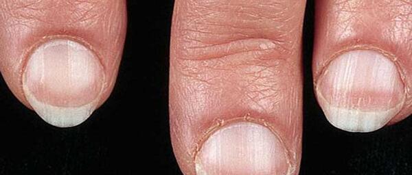 عکس ناخن های سالم