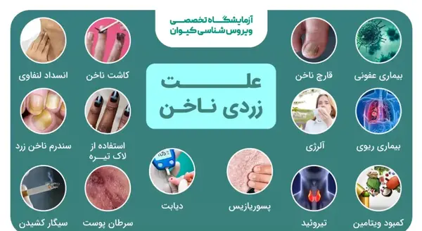 عکس زردی ناخن