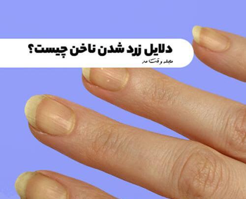 عکس زردی ناخن