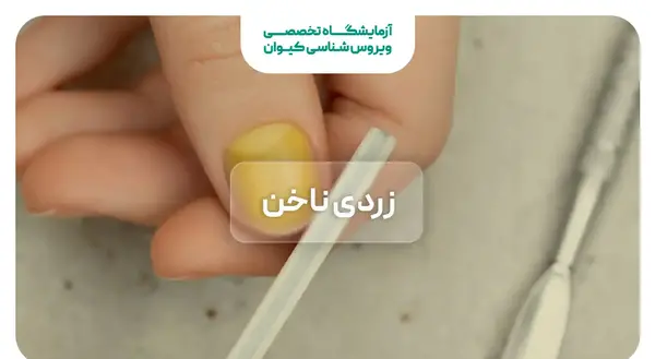 عکس زردی ناخن