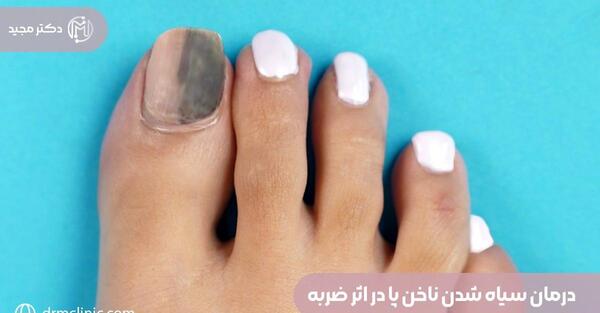 عکس ناخن شکسته خونی