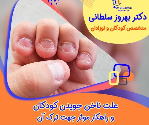 عکس ناخن جویدن کودکان