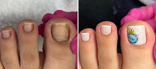 عکس ناخن ژلیش پا