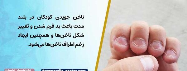 عکس ناخن جویده شده کودکان
