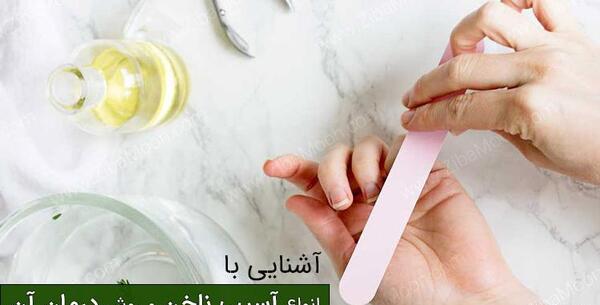عکس ناخن های آسیب دیده