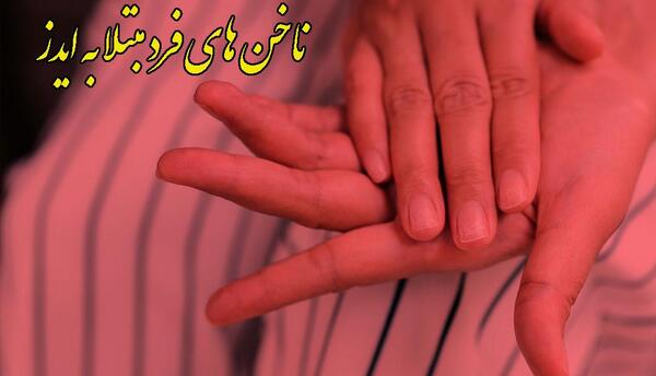 عکس ناخن بیمار ایدزی