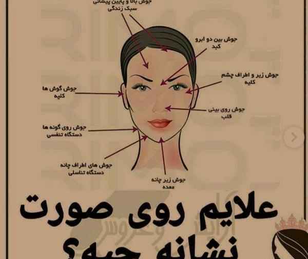 عکس جوش تناسلی در دختر مجرد نی نی سایت