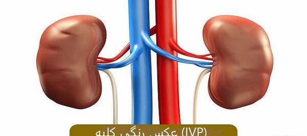 عکس رنگی نی نی سایت ۱۴۰۲
