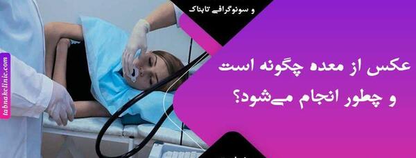 عکس رنگی معده نی نی سایت
