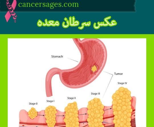 عکس رنگی معده نی نی سایت