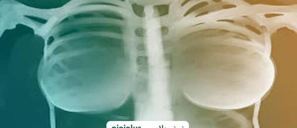 عکس رنگی معده نی نی سایت